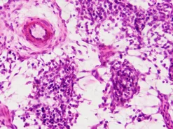 Dauerpräparate: Histologie><noscript><img width=
